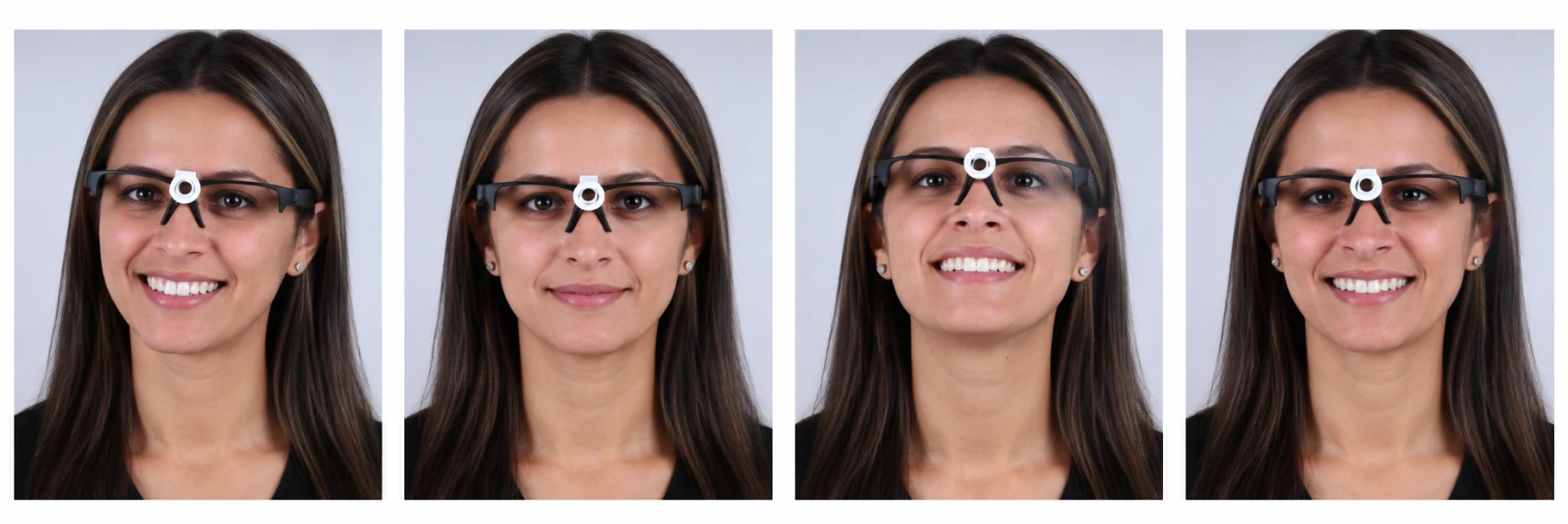 Sequência de quatro fotografias frontais com o F.I.D. em que a cabeça aparece inclinada, demonstrando posicionamento fora do padrão.